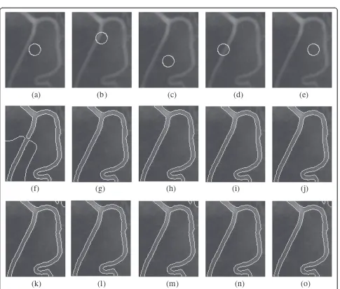 Figure 1 Results of the RSF and LIF models for a vessel image with five distinct initial contour locations.initial contours