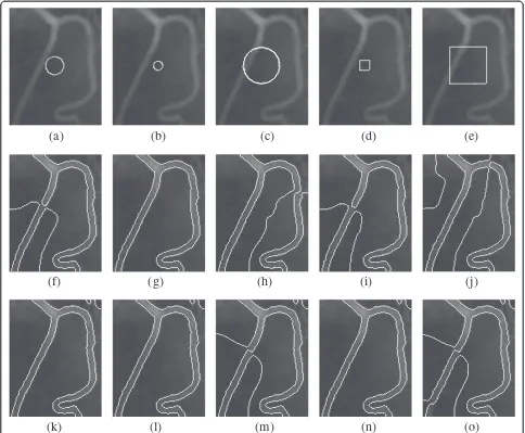Figure 2 Results of the RSF and LIF models for a vessel image with five distinct initial contour sizes and shapes