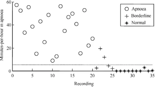 Fig. 5.The number of minutes per hour spent in apnoea as estimated bythe regularized QD classifier processing all features for all recordings of thereleased-set