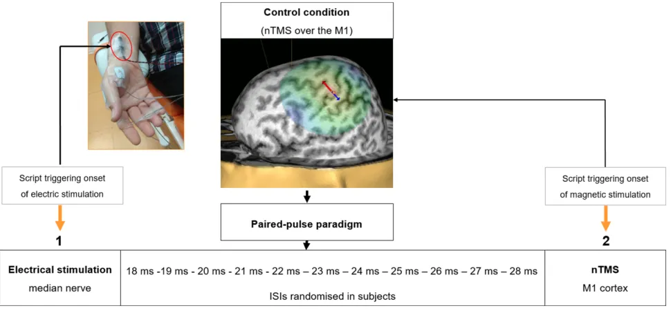 Figure 2 Diagram of paired-pulse paradigm for SAI investigation. figure depicts a 3D reconstruction of MRI with the M1 hotspot for APB muscle and positioning of stimulating bar electrode at the wrist with surface electrodes attached over the APB Notes: The