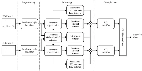 Fig. 2.Schematic representation of classifier configuration IX for the automated processing of the ECG for classification of heartbeats.