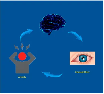 Figure 4 Relationship between MRI images and CU.