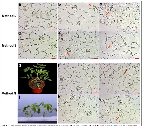 Fig. 1 Guard cells at different stages of enzymatic digestion in Method L (a–c) and Method S (d–l)