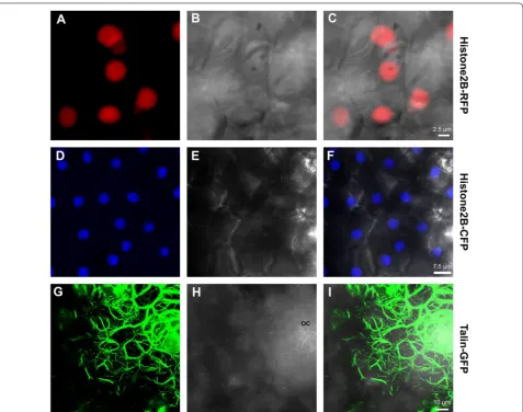 Fig. 5 CLSM‑projected Z series of abaxial transgenic Duncan grapefruit leaf epidermal cells stably expressing either Histone2B‑RFP (a–c), Histone2B‑CFP (d–f) and Talin‑GFP (g–i)