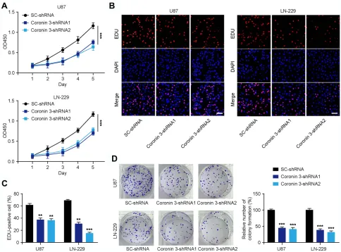 Figure 2 Knockdown of Coronin 3 inhibits the proliferation of glioblastoma (GBM) cells in vitro