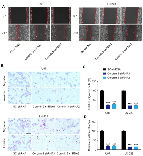 Figure 3 Coronin 3 knockdown suppresses glioblastoma (GBM) cell migration and invasion in vitro