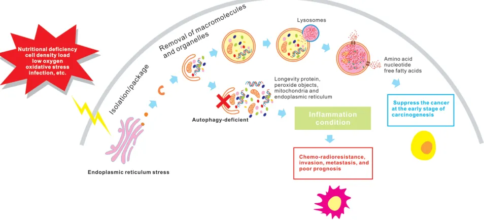 Figure 1 The dual roles of autophagy. Depending on the context and stage of cancer development, autophagy may play neutral, cancer-inhibiting, or cancer-promoting roles.In general, the function of autophagy is to suppress cancer at early stages of carcinog