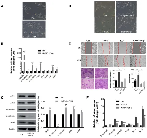 Figure 3 UBE2O knockout impairs the TGF-β1-induced EMT process. (A) Overexpression of UBE2O induced EMT-related morphological changes in Tu686 cells