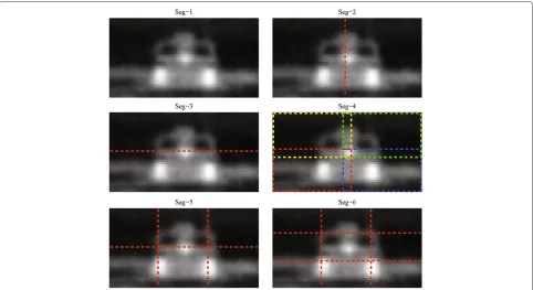 Figure 7 Recognition accuracy comparison for eight operators. LBP, CCLBP, LTP, CCLTP, SLBP, CCSLBP, CLBP, and CCCLBP.