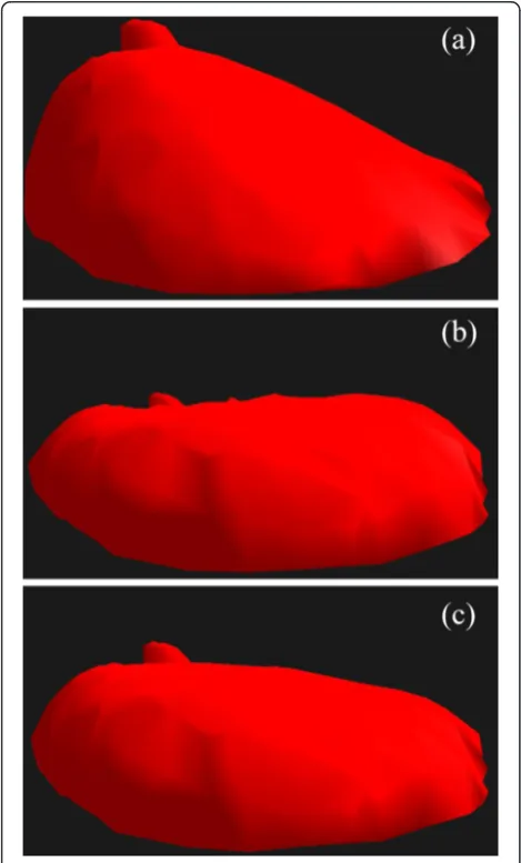 Figure 7 shows the result for patient number four. The