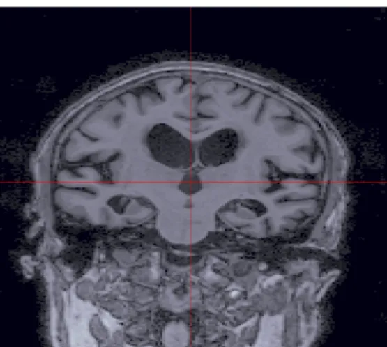 Figure 2.9: Example image of a MRI scan along axial view