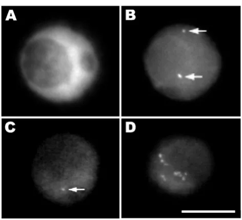 Figure 3Transgene sites visualized in tobacco isolated nucleiTransgene sites visualized in tobacco isolated nuclei