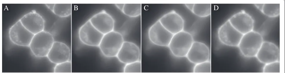 Figure 6 Smoothing of stained nuclei of Hela-Kyoto cells in 2D by Example 4. A) Raw nuclei stain, B) smoothing of A by edge enhancingdiffusion (method = ’eed’)