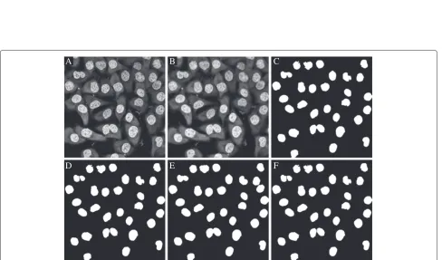 Figure 11 Segmentation of cells using manually drawn markers in 3D from example 9, visualized for plane five
