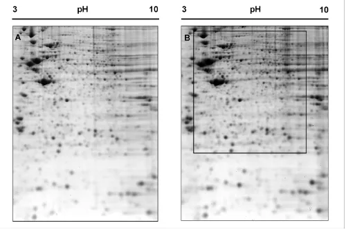 Figure 12-DE pattern of untreated (A) and 6 h morphine-treated (B) SH-SY5Y cells2-DE pattern of untreated (A) and 6 h morphine-treated (B) SH-SY5Y cells