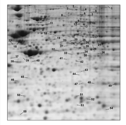 Figure 2phine treatmentClose-up from a representative 2-D gel showing the spots whose abundance in SH-SY5Y cells is regulated after chronic mor-Close-up from a representative 2-D gel showing the spots whose abundance in SH-SY5Y cells is regulated after chr