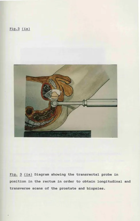 Fig.3 (ia)