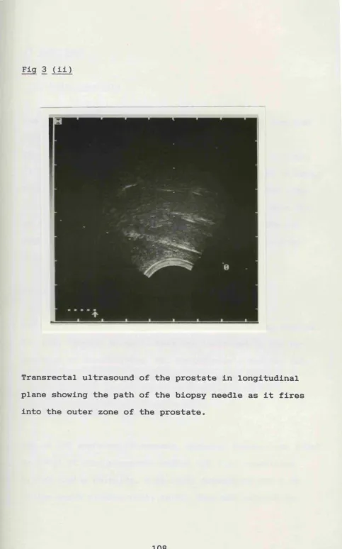 Fig 3 (ii)
