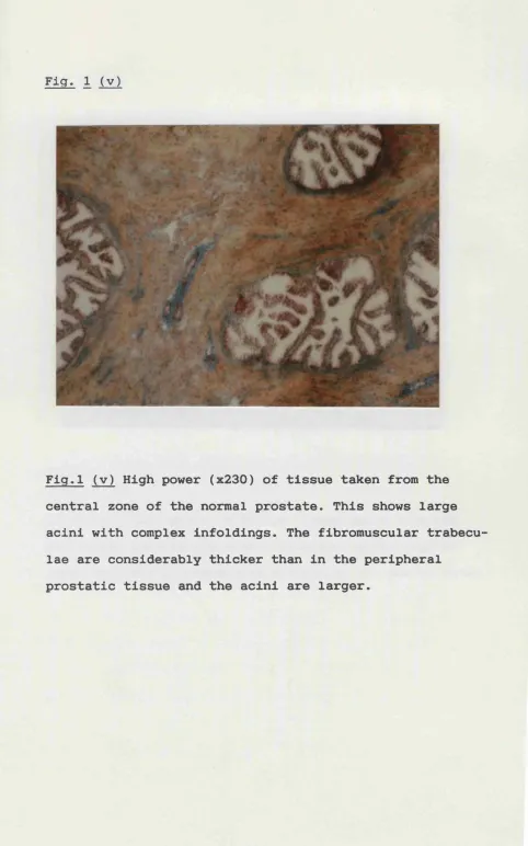 Fig. 1 (v)