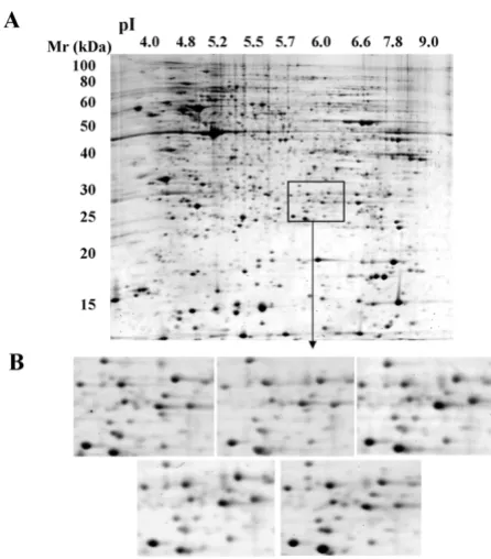 Figure 1 depicts the same area for five 2D gels generated