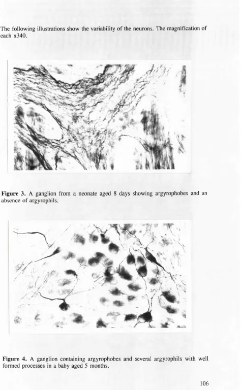 Figure 3. A ganglion from a neonate aged 8 days showing argyrophobes and an 