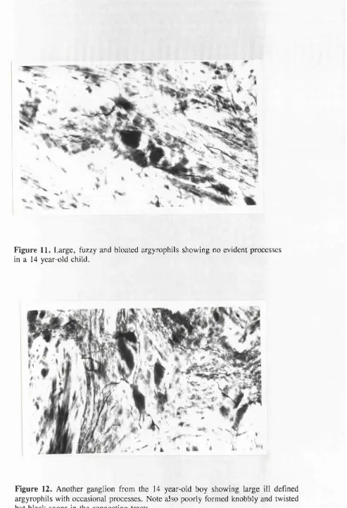 Figure 11. Large, fuzzy and bloated argyrophils showing no evident processes 