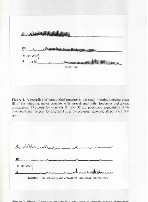 Figure 1. A recording of intraluminal pressure in the small intestine showing phase 