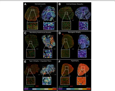 Fig. 7 Color-coded maps as a tool to visually detect muscle disease and extreme muscle morphometry