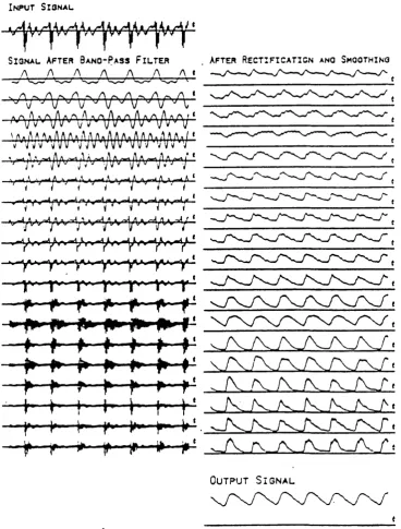 Figure 4.14 Operational waveforms from multi-channel epoch detector used by Yaggi. The bandpass filters covered the range of 120Hz to 3.8kHz and their bandwidths varied between 114Hz to 442Hz, from top trace to bottom trace respectively
