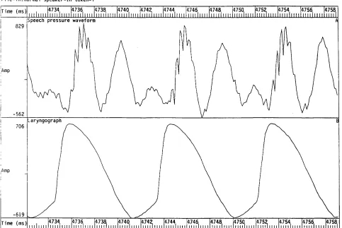 Figure 2.7 Speech pressure waveform and laryngograph waveform for an example of normal speech.