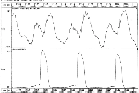 Figure 2.8 Speech pressure waveform and laryngograph waveform for an example of 