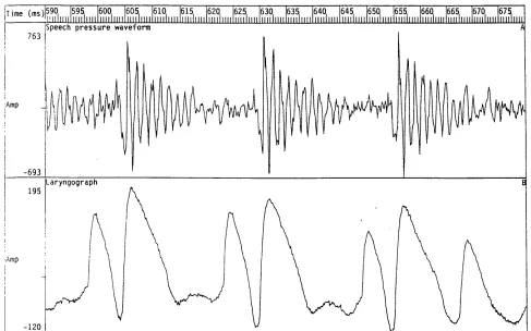 Figure 2.9 Speech pressure waveform and laryngograph waveform for an example of 