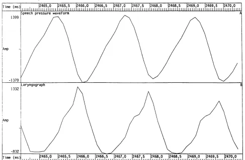 Figure 2.10 Speech pressure waveform and laryngograph waveform for an example of 