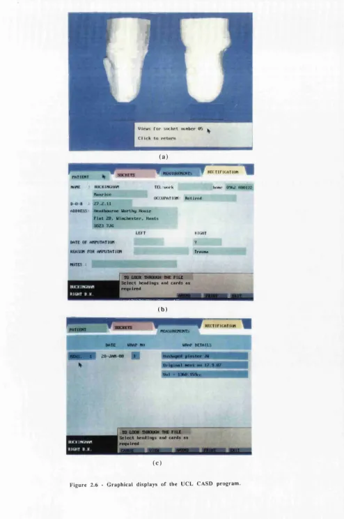 Figure 2.6 - Graphical displays of the UCL CASD program.