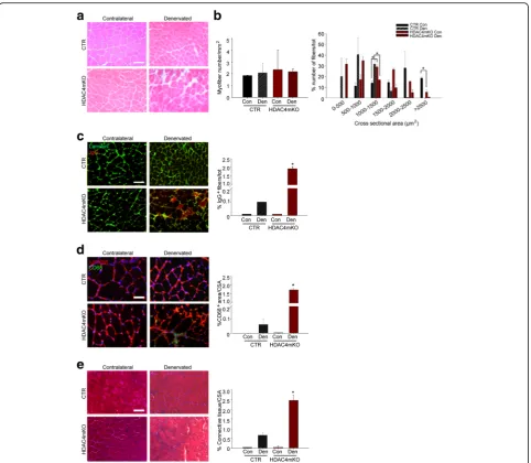 Fig. 1 Skeletal muscles lacking HDAC4 shows compromised integrity following long-term denervation.pquantification, following 1 week of denervation
