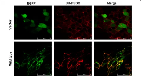 Figure 4 Uptake of DiI-oxLDL by the transfected 293T cells.293T cells were transiently transfected with pEGFP-N3 empty vector,wild-type SR-PSOX and different mutant constructs respectively.After 24 hours transfection, cells were incubated with DiI-oxLDL fo