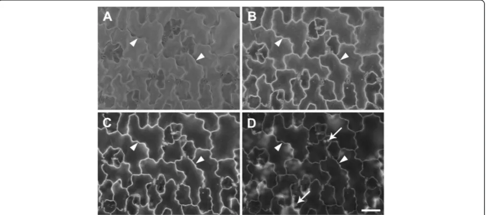 Figure 2 Effect of accelerating voltage on BSE imaging of cell wall outlines in critical point dried A