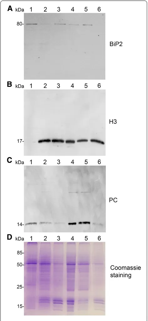 Figure 2 Analysis of protein fractions from different steps ofnuclei isolation. The protein fractions obtained following the mainsteps of the procedure used for isolation of nuclei from leaves ofapple are shown