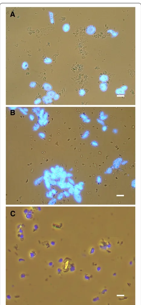 Figure 3 Preparations of nuclei obtained following the finalpurification on 35% Percoll cushion by centrifugation.Preparations of nuclei from leaves of (A) tobacco, (B) potato and (C)apple obtained after the final purification on 35% Percoll cushion bycent