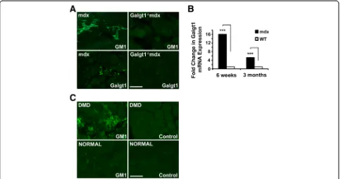 Figure 2 GM1 andage.otherwise normal human muscle. Errors in Galgt1 expression in dystrophic skeletal muscle