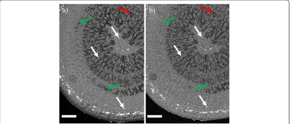 Figure 5 Partial refilling of a vessel element.approximately 300 × 600 The images show the surroundings of the embolized vessel in Figure 4 in greater detail, withimages a) and c) corresponding to Figure 4a, and b) and d) corresponding to Figure 4b