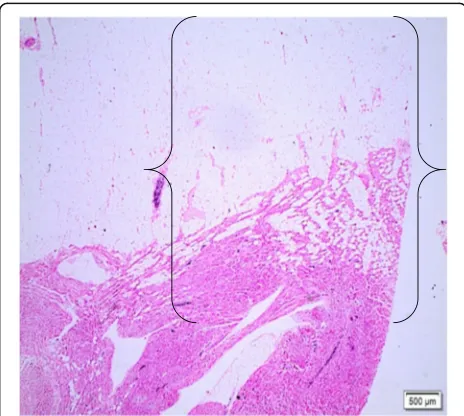 Fig. 3 Photomicrographs of cardiac samples showing adipose deposition in anatomical compartments of the LV