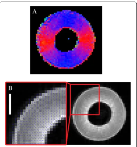 Figure 15 Confocal micrograph of the pericarp of a grapeberry prior to véraison 41 DAF (transverse plane)