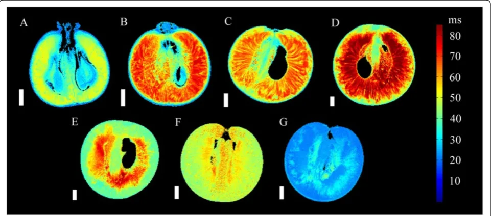 Figure 4 Transverse relaxation images of grape berries at seven different stages of berry development (transverse plane).100078 × 78 × 100086 × 86 × 1000 The imagesinclude three pre-véraison grapes, at 28 DAF (A, voxel size 59 × 59 × 1000 μm), 41 DAF (B, v