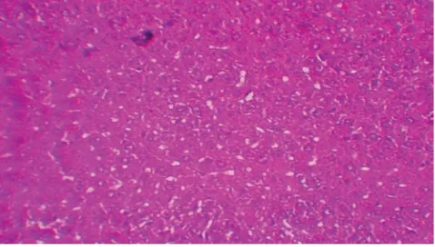 Fig. 3: Photomicrograph of liver from NAC-treated groupLiver sections from N-acetyl-L-cysteine (NAC)-treated group 3 rats stained with HE showed no signs of pathological change except for sinusoidal dilatation