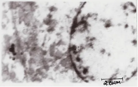 Fig. 8: TEM image of hepatocyte of GTE-treated groupHepatocyte from green tea extract (GTE) treated group 4 rats, showed clumping of shrunken mitochondria, mild reconstitution of rough endoplasmic reticulum and margination of chromatin