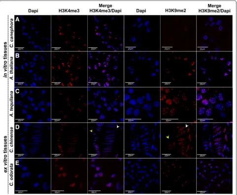 Figure 4 Visualization of H3K4me3 and H3K9me2 in specific cells in different plants. Immunodetection was carried out with specificantibodies against H3K4me3 and H3K9me2