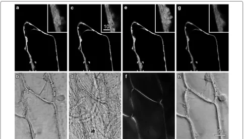 Fig. 1 The importance of optimised illumination for transmitted light imaging. Onion epidermal cells transiently expressing a cytosolic targeted YFP fluorescence and transmitted light imaging, with the transmitted light path set for Köhler illumination