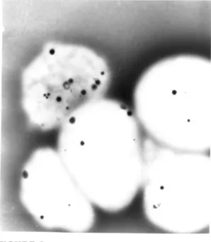 FIGURE 3Example of HPS platelets revealing total absenceof d granules.