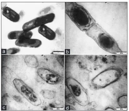 Fig. 4: Effects on the growth of Bacillus cereusEffect of addition the methanol extract of (at MIC value of 3.13 mg/ml) on the growth profile of Arrows indicated the time (h) of extract addition to the bacterial culture